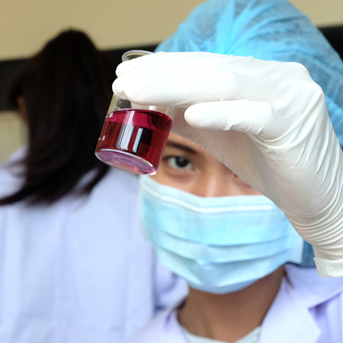 Cara Cek Gula Darah Pada Anak Dengan Tepat dan Benar