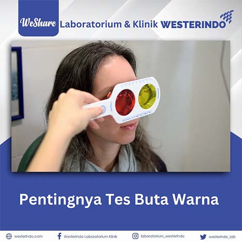 Pentingnya Tes Buta Warna