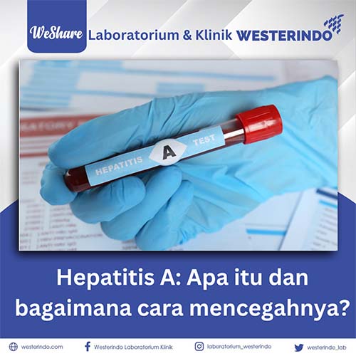 Hepatitis A: Apa itu dan bagaimana cara mencegahnya?