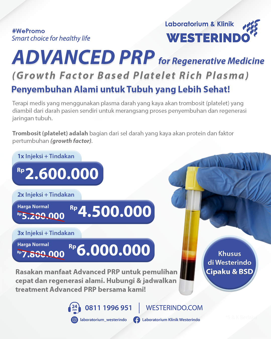 Advanced PRP Regenerative Medicine: Penyembuhan Alami untuk Tubuh yang Lebih Sehat