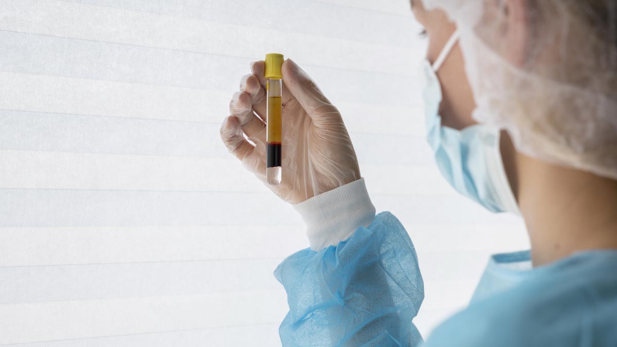 Apa Itu Platelet Rich Plasma (PRP) ?