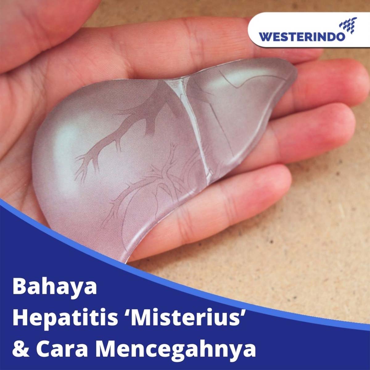 Bahaya Hepatitis ‘Misterius’
