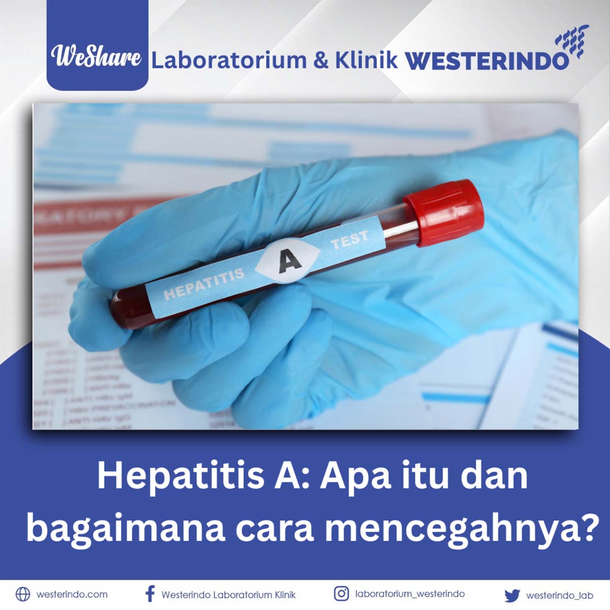 Hepatitis A: Apa itu dan bagaimana cara mencegahnya?