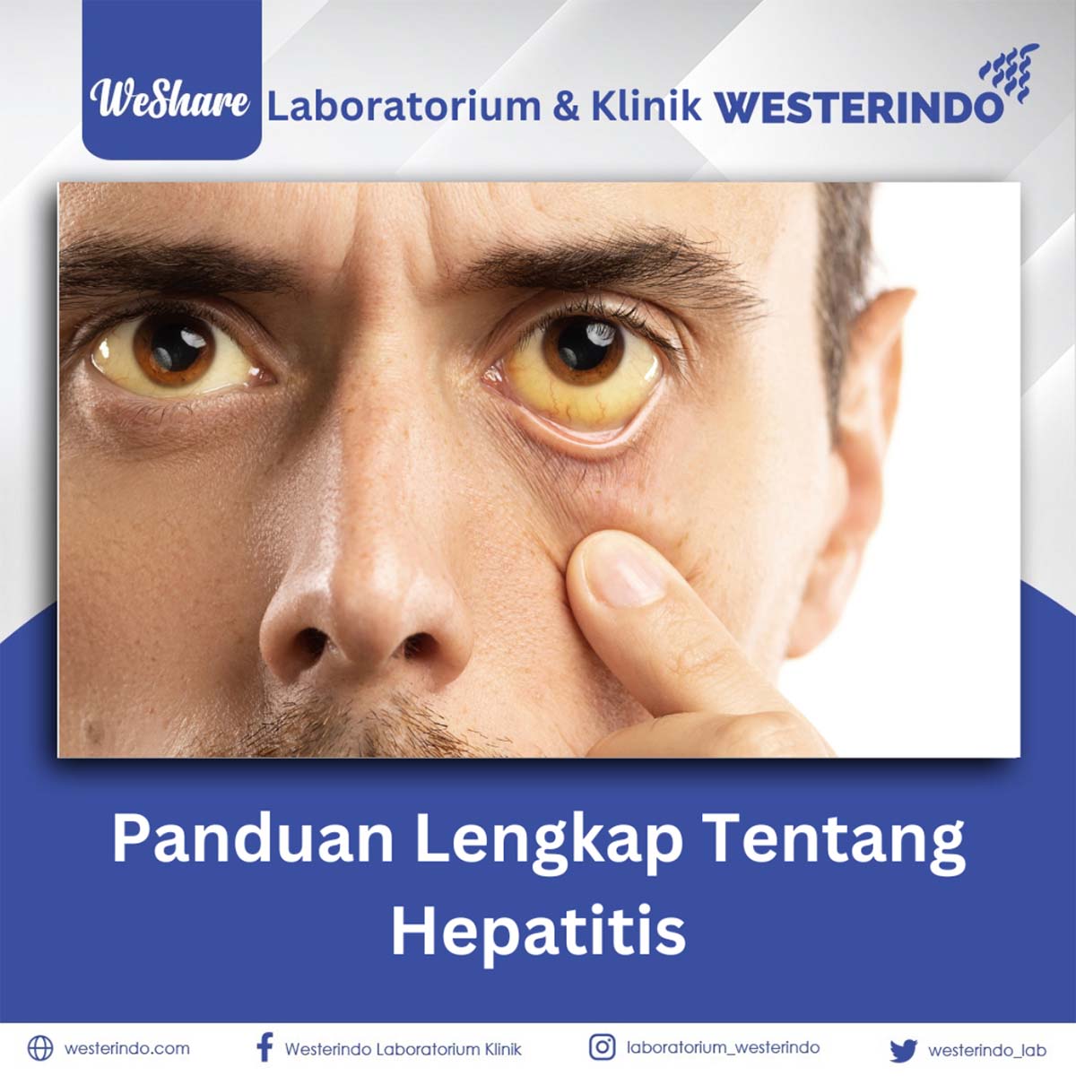 Panduan Terlengkap tentang Hepatitis