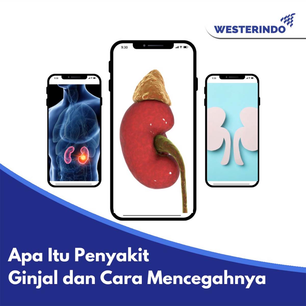 Penyakit Ginjal