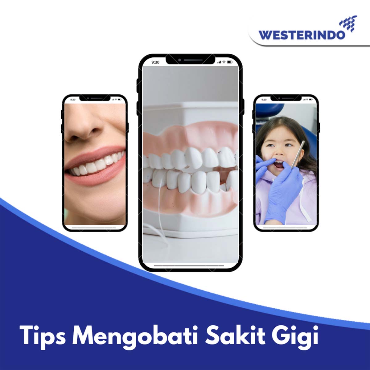 Tips Mengobati Sakit Gigi