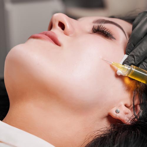 Platelet Rich Plasma / PRP, Solusi Perawatan Kulit Wajah